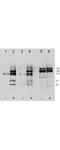 c-met antibody, P01488, Boster Biological Technology, Western Blot image 