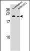 RAB12, Member RAS Oncogene Family antibody, PA5-48179, Invitrogen Antibodies, Western Blot image 