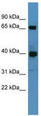 Polypeptide N-Acetylgalactosaminyltransferase 11 antibody, TA338482, Origene, Western Blot image 