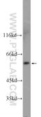 UDP-N-Acetylglucosamine Pyrophosphorylase 1 Like 1 antibody, 25262-1-AP, Proteintech Group, Western Blot image 