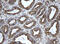 Epoxide Hydrolase 1 antibody, M00899, Boster Biological Technology, Immunohistochemistry paraffin image 
