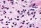 CD294 antibody, MBS243490, MyBioSource, Immunohistochemistry paraffin image 