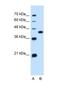 Solute Carrier Family 14 Member 1 (Kidd Blood Group) antibody, NBP1-60115, Novus Biologicals, Western Blot image 
