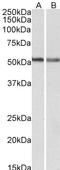 Cannabinoid Receptor 1 antibody, LS-C139816, Lifespan Biosciences, Western Blot image 