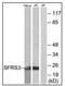 Serine And Arginine Rich Splicing Factor 3 antibody, AP31722PU-N, Origene, Western Blot image 