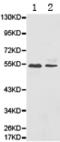 ATPase H+ Transporting Accessory Protein 1 antibody, TA321298, Origene, Western Blot image 
