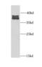 Protein Kinase AMP-Activated Non-Catalytic Subunit Gamma 1 antibody, FNab00379, FineTest, Western Blot image 