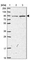 Malignant Fibrous Histiocytoma Amplified Sequence 1 antibody, NBP2-30382, Novus Biologicals, Western Blot image 