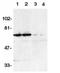 TNF Receptor Superfamily Member 21 antibody, SP1298, Origene, Western Blot image 