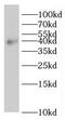 Rod outer segment membrane protein 1 antibody, FNab07382, FineTest, Western Blot image 