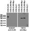 CLN3 Lysosomal/Endosomal Transmembrane Protein, Battenin antibody, 73-390, Antibodies Incorporated, Western Blot image 