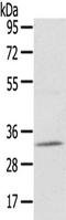 Uridine Phosphorylase 2 antibody, TA351904, Origene, Western Blot image 