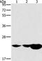 Phospholipase A And Acyltransferase 2 antibody, PA5-50680, Invitrogen Antibodies, Western Blot image 