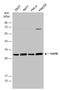 VAMP Associated Protein B And C antibody, GTX131631, GeneTex, Western Blot image 