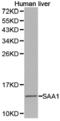 Serum Amyloid A1 antibody, LS-C192896, Lifespan Biosciences, Western Blot image 