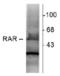 RAR-alpha antibody, NB200-322, Novus Biologicals, Western Blot image 
