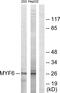 Myogenic factor 6 antibody, GTX87125, GeneTex, Western Blot image 
