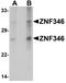 Zinc Finger Protein 346 antibody, TA326612, Origene, Western Blot image 