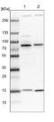 Ankyrin Repeat Domain 13A antibody, NBP1-89082, Novus Biologicals, Western Blot image 