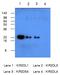 Killer Cell Immunoglobulin Like Receptor, Two Ig Domains And Long Cytoplasmic Tail 1 antibody, SM6033, Origene, Western Blot image 