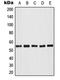 Akt antibody, LS-C351802, Lifespan Biosciences, Western Blot image 