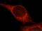 Spermatogenesis Associated Serine Rich 2 Like antibody, 16938-1-AP, Proteintech Group, Immunofluorescence image 