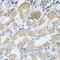Renal carcinoma antigen NY-REN-26 antibody, FNab00854, FineTest, Immunohistochemistry frozen image 