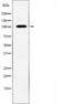 TATA-Box Binding Protein Associated Factor 3 antibody, orb227102, Biorbyt, Western Blot image 