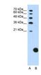 Ribosomal Protein S29 antibody, NBP1-57477, Novus Biologicals, Western Blot image 