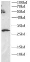 Secreted And Transmembrane 1 antibody, FNab10722, FineTest, Western Blot image 