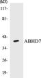 Epoxide Hydrolase 4 antibody, EKC1010, Boster Biological Technology, Western Blot image 