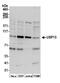 Ubiquitin carboxyl-terminal hydrolase 13 antibody, NBP1-46203, Novus Biologicals, Western Blot image 