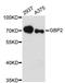 Guanylate Binding Protein 2 antibody, LS-C748059, Lifespan Biosciences, Western Blot image 