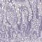 Keratin 82 antibody, NBP2-57921, Novus Biologicals, Immunohistochemistry frozen image 