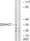 Zinc Finger DHHC-Type Containing 7 antibody, GTX87016, GeneTex, Western Blot image 