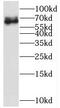 SSX Family Member 2 Interacting Protein antibody, FNab08258, FineTest, Western Blot image 