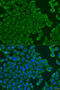 Arachidonate Lipoxygenase 3 antibody, 23-475, ProSci, Immunofluorescence image 