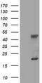 Tet Methylcytosine Dioxygenase 1 antibody, TA802234, Origene, Western Blot image 