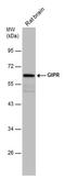 Gastric Inhibitory Polypeptide Receptor antibody, PA5-78456, Invitrogen Antibodies, Western Blot image 