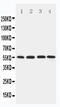 Solute Carrier Family 2 Member 5 antibody, LS-C313192, Lifespan Biosciences, Western Blot image 