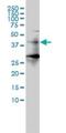 Histone Deacetylase 11 antibody, H00079885-M01, Novus Biologicals, Western Blot image 