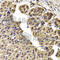 Chaperonin Containing TCP1 Subunit 2 antibody, A6546, ABclonal Technology, Immunohistochemistry paraffin image 