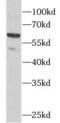 Carboxylesterase 2 antibody, FNab01616, FineTest, Western Blot image 