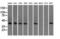 Sterol O-Acyltransferase 2 antibody, LS-C115244, Lifespan Biosciences, Western Blot image 