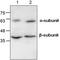 Adhesion G Protein-Coupled Receptor E2 antibody, TA318942, Origene, Western Blot image 
