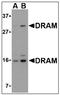 DNA Damage Regulated Autophagy Modulator 1 antibody, AP08946PU-N, Origene, Western Blot image 