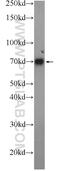 C4BPA antibody, 11819-1-AP, Proteintech Group, Western Blot image 