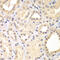 Spindlin Family Member 2B antibody, A14826, Boster Biological Technology, Immunohistochemistry paraffin image 