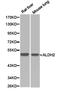 Aldehyde Dehydrogenase 2 Family Member antibody, TA327010, Origene, Western Blot image 
