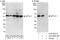 Serine palmitoyltransferase 1 antibody, A303-407A, Bethyl Labs, Immunoprecipitation image 